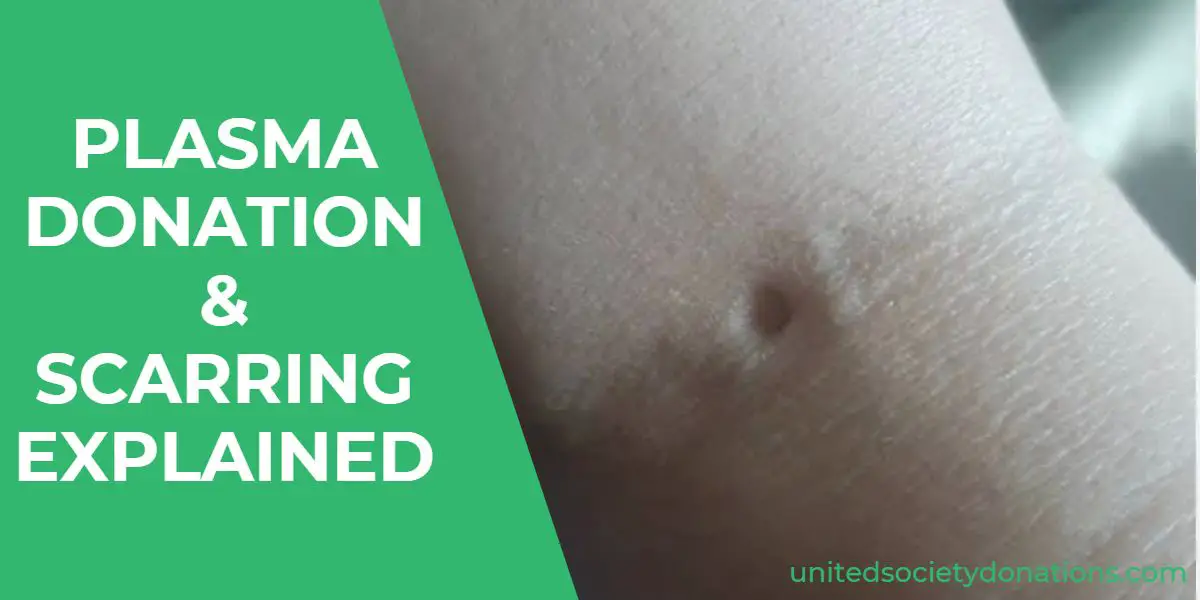 plasma donation scar