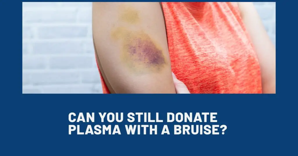 Can You Still Donate Plasma With A Bruise