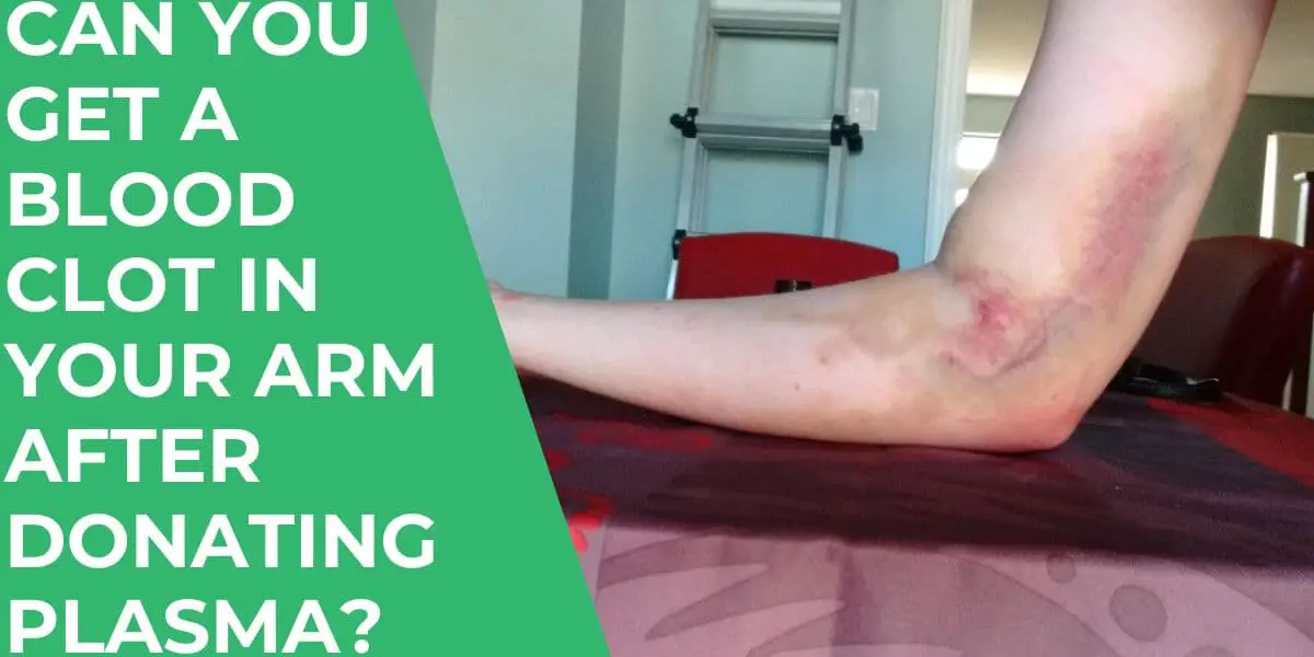 Lump in Arm After Donating Plasma Cause, Symptom, Treatment