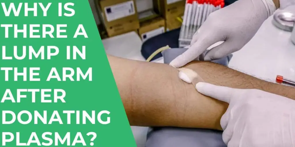 Why is There a Lump in the Arm After Donating Plasma?